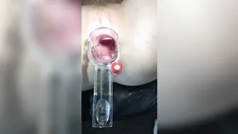 petite nymphet onlyfans a nice, close-up view of my cervix