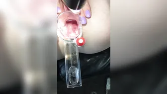 petite nymphet onlyfans a nice, close-up view of my cervix