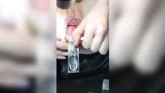 petite nymphet onlyfans a nice, close-up view of my cervix