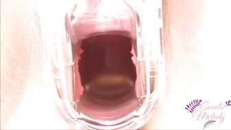 Sweetxmelody Vicious bitch pulls vagina with fingers